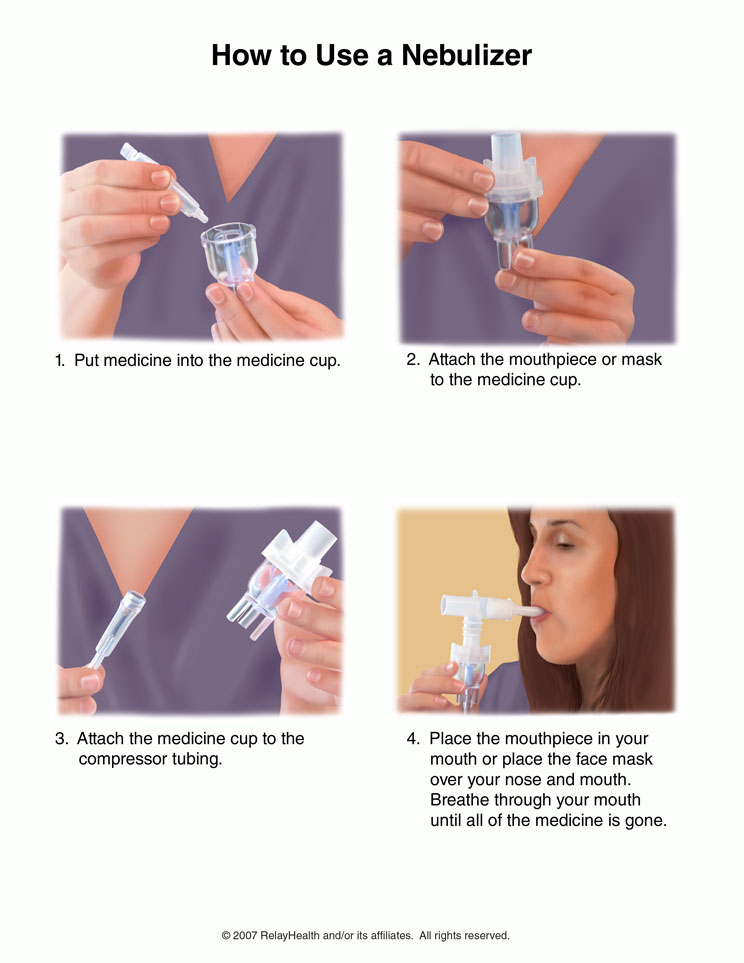 Nebulizer, How to Use: Illustration