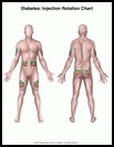 Thumbnail image of: Diabetes, Injection Rotation Chart: Illustration