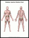 Thumbnail image of: Diabetes, Injection Rotation Chart: Illustration