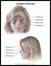 Thumbnail image of: Sinuses: Illustration