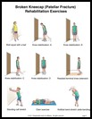 Thumbnail image of: Broken Kneecap Exercises, Page 2: Illustration