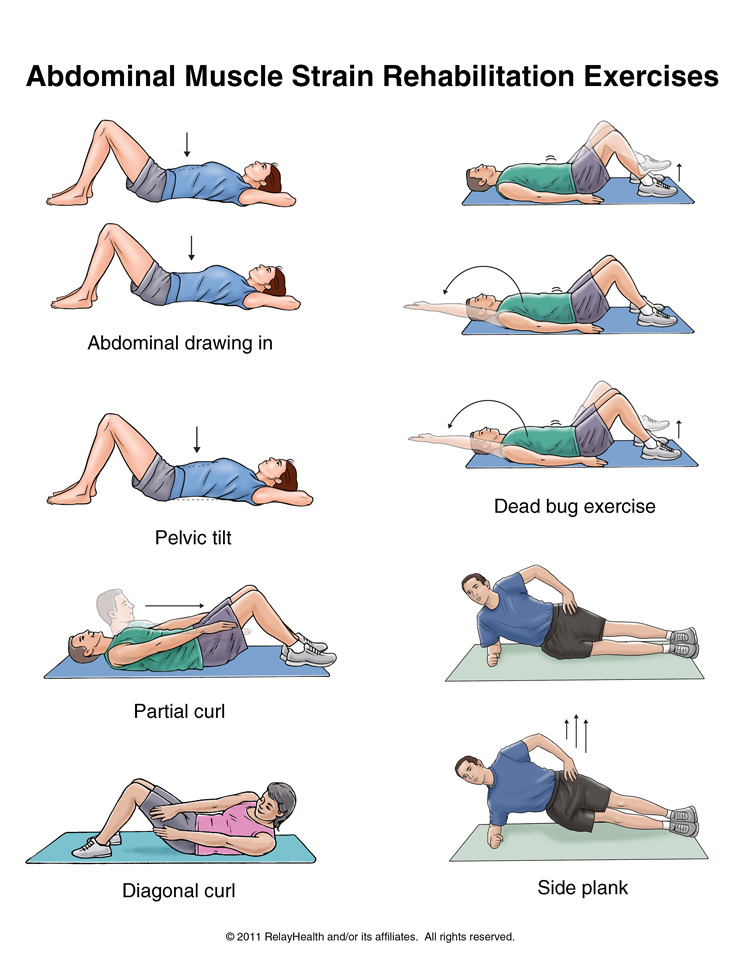 Abdominal Muscle Strain Exercises: Illustration